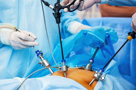 Gynaec Surgeries Including Laparoscopic