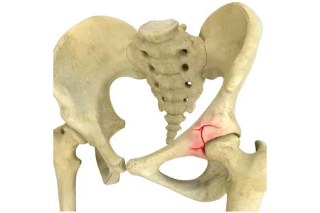 Pelvic & Acetabulum Fracture Management